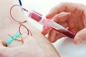 Implied-Consent-Blood-Test-Cases